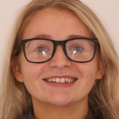 Braces & Bonding Smile before